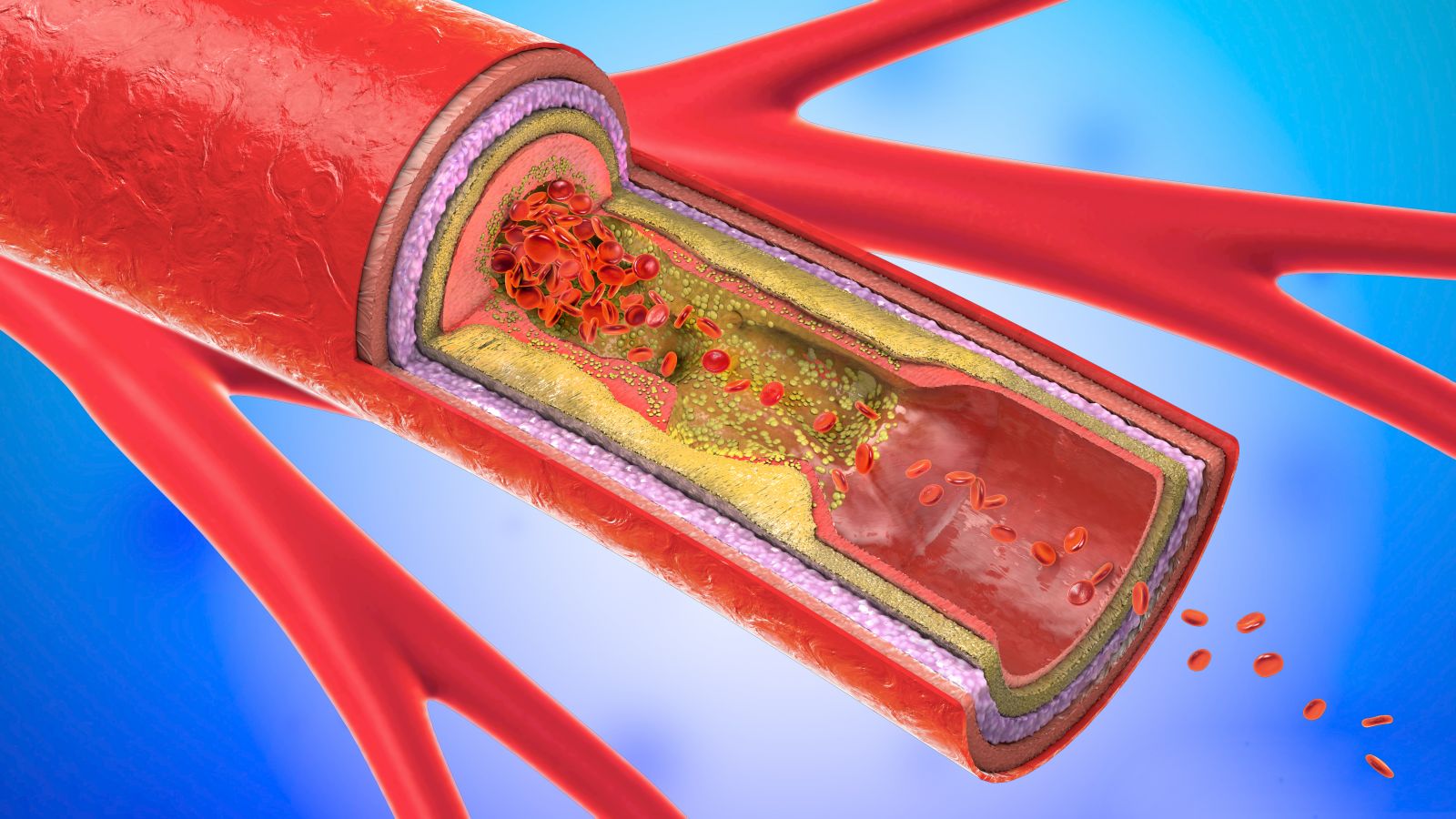 Know about carotid artery location & carotid artery testing with ACCESS HEALTH CARE PHYSICIANS, LLC in Florida.